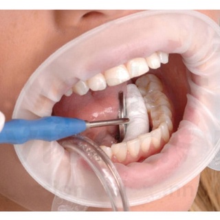 【ddydental】อุปกรณ์ฆ่าเชื้อ สําหรับดูแลช่องปาก