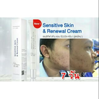 Sensitive Skin &amp; Renewal Cream เซนซิทีฟ สกิน แอนด์ รีนิววอล ครีม บำรุงผิว รักษาสิว master piece life vision มาสเตอร์พีซ