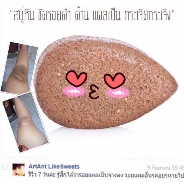 โปร1เเถม1-ส่งฟรี-สบู่ยางลบ-ลบรอยเเตกลาย-จุดด่างดำ