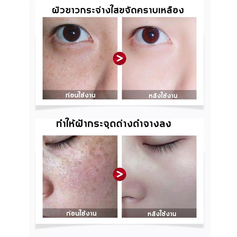 dsiuan-ครีมทาฝ้า-จางลงฝ้ากระที่หนักได้-ลดเม็ดสีเมลานิน-กำจัดฝ้า-จุดด่างดำ-ฝ้า-กระ-กระจ่างใสผิว-ไม่เหนียวเหนอะหนะ-ซึมซับดี-ครีมทาฝ้า-ครีมทาฝ้ากระ-ครีมฝ้ากระ-ครีมทาหน้า-ครีมรักษาฝ้า-ครีมลดฝ้า-ครีมหน้าขา