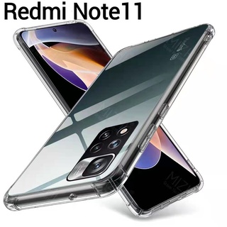 เคสกันกระแทก เคสXiaomi Redmi Note11 4G/ Note11S/Redmi Note 11Pro/Redmi Note11Pro Plus เคสใส คลุมกล้อง เคสนิ่ม ส่งจากไทย