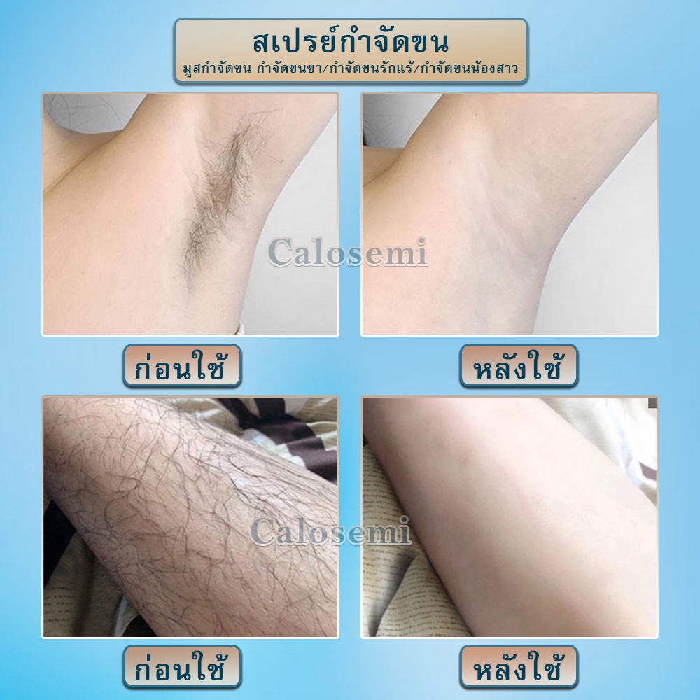 calosemi-มูสกำจัดขนถาวร-มูสกำจัดขน-สเปรย์กำจัดขน-กำจัดขนขา-กำจัดขนรักแร้-กำจัดขนน้องสาว