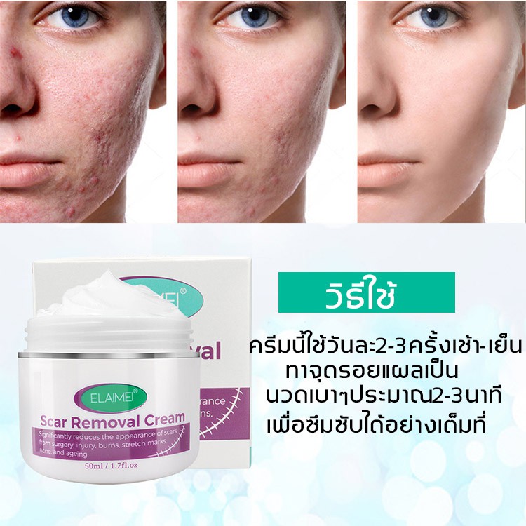 better-ครีมลดรอยแผลเป็น-ครีมลบรอยแผลเป็น-50ml-ทารอยแผลเป็น-ครีมลบแผลเป็น-ครีมทาแผลเป็น-รักษารอยแผลเป็น-ครีมลดรอยสิว