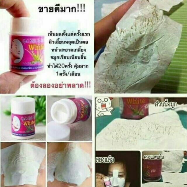 พร้อมส่ง-หลุดเป็นตอ-ครีมลอกสิวเสี้ยนเวียดนามของแท้-ในชุดมีครีม-กระดาษ-วิธีใช้