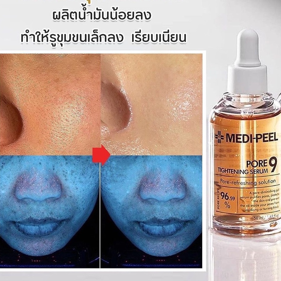 medi-peel-pore-9-tightening-serum-50ml-เซรั้มกระชับรูขุมขนกว้าง