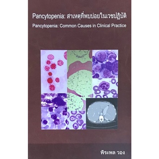 PANCYTOPENIA: สาเหตุที่พบบ่อยในเวชปฏิบัติ (PANCYTOPENIA :COMMON CAUSES IN CLINICAL PRACTICE)