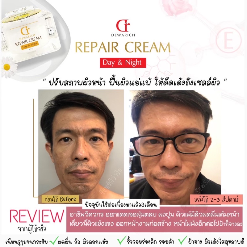 ส่งฟรี-preme-skincare-เซ็ตกู้หน้าสิวผิวเด้ง-พร้อมกันแดด-ปกป้องผิว-ขาวกระจ่างใส-ผิวเด็ก-ผิวเด้ง-ครีมโกงอายุ