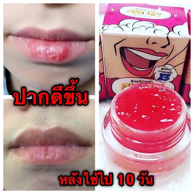 ลิปแก้ปากดำ ปากชมพูถาวร | Shopee Thailand