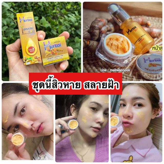 บอกลาหน้าสิว-herbal-ครีมขมิ้นแท้100-มี-อย-ไร้สาร