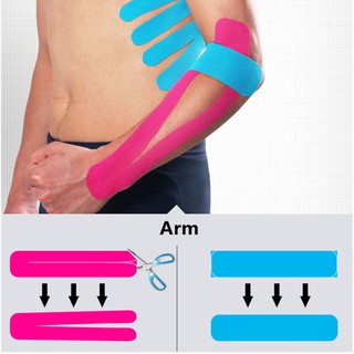 เทปบำบัด Kinesiology Tape เทปติดกล้ามเนื้อ เทปพยุงกล้ามเนื้อ เทปยืดหยุ่น ช่วยลดความเจ็บปวด ลดความรุ่นแรง