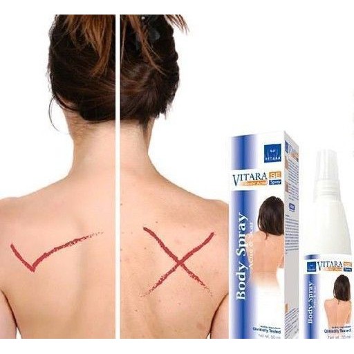 สเปรย์ลดสิว-รอยดำ-รอยแผล-vitara-se-body-acne-spray-50มล