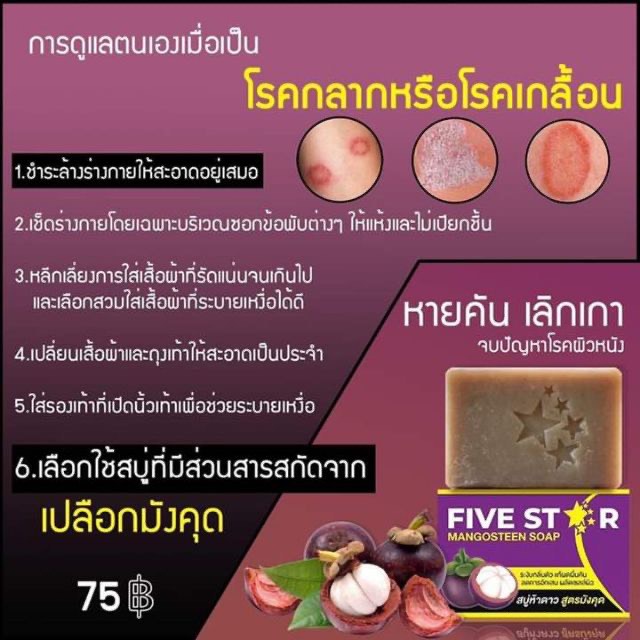 fivestar-สบู่มังคุด-5ดาว-สบู่รักษาโรคผิวหนัง-ขนาด100กรัม-สบู่สมุนไพร-แก้อาการคัน-ช่วยรักษาอาการผดผื่นคัน