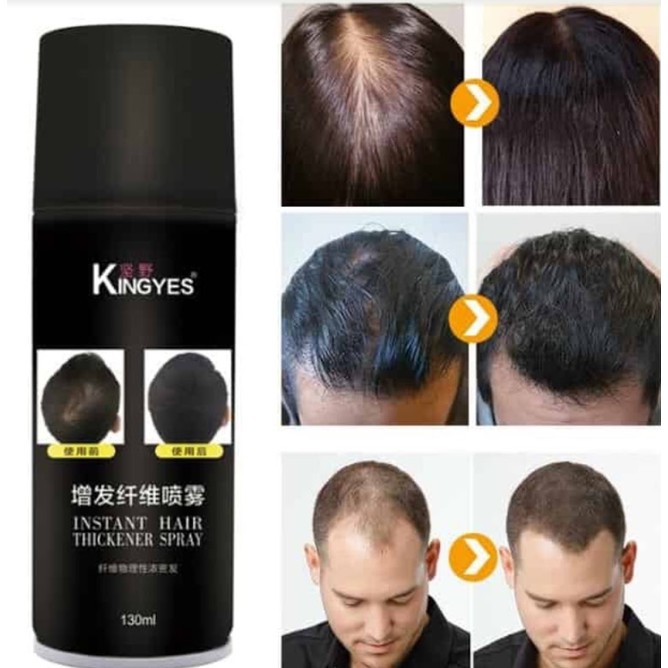 kingyes-hair-spray-สเปรย์ผมไฟเบอร์-ปิดผมบาง-แกปัญหาหัวล้าน