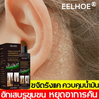 EELHOE 100ml แชมพูแก้ผมร่วง แชมพูคัน ยาสระผมรังแค ดูแลหนังศีรษะ บำรุงรากผม ยาสระผมเชื้อรา แชมพูขจัดรังแค แชมพูขจัดรังแค