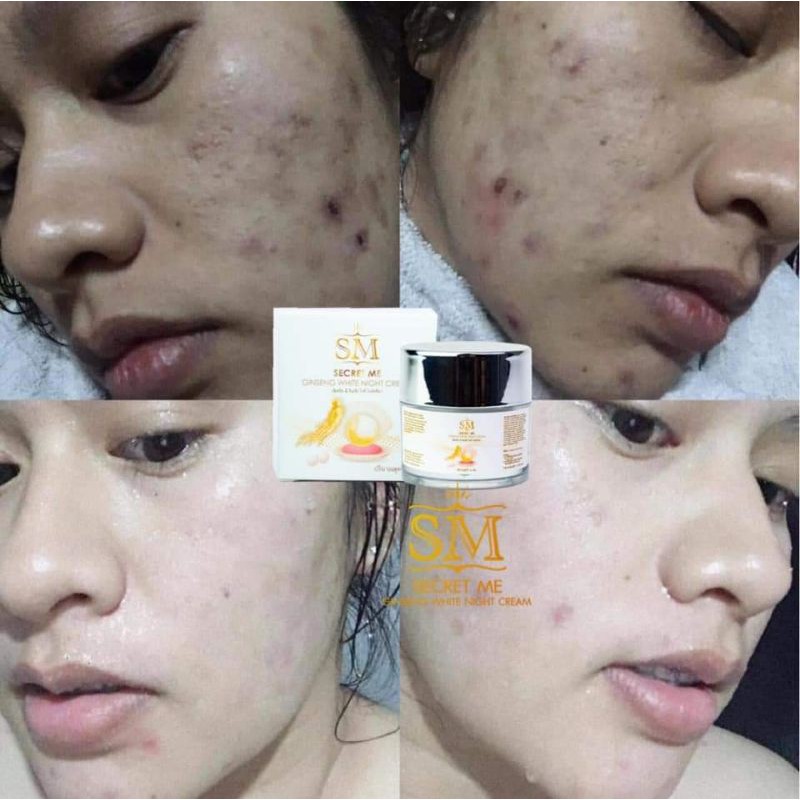 พร้อมส่ง-sm-skin-me-เซ็ตคู่-จบทุกปัญหาผิวหน้า