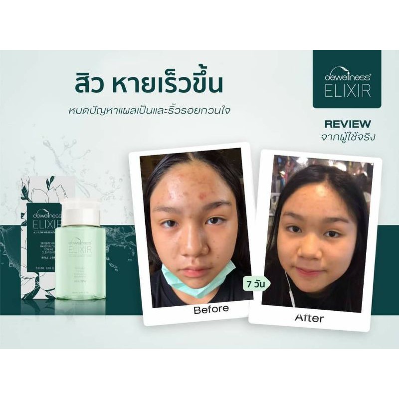 ส่งด่วน-พร้อมส่ง-สินค้าขายดี-น้ำค้าง-บิวตี้-วอเตอร์-เช็ดผิวสะอาดพร้อมบำรุง-6in1