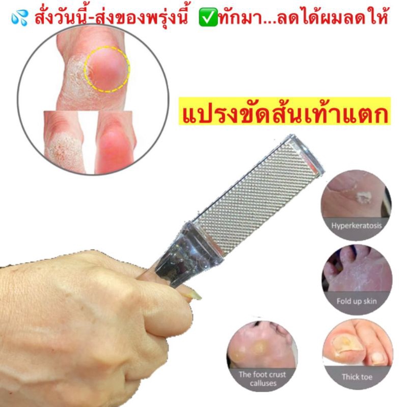 chsn10-จิ๋ว-แปรงขัดส้นเท้า-จิ้ว-foot-file-pedicure-ขัดเท้าแตก-แปรงขัดเท้า