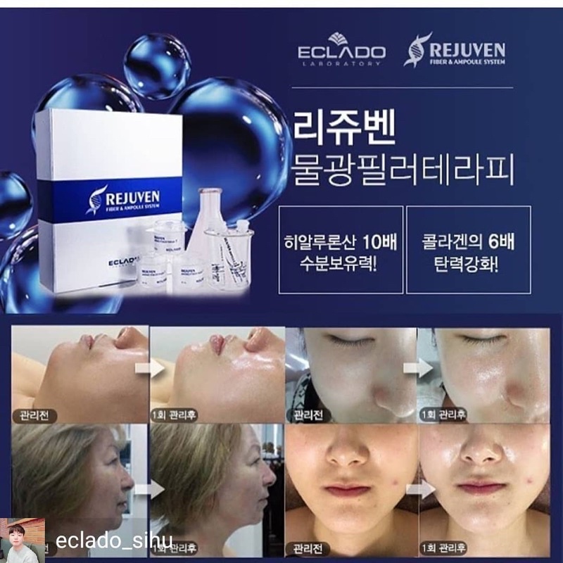 ทรีทเมนต์หน้าเซ็ต-rejuven-fiber-amp-ampoule-system