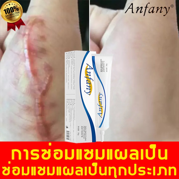 ครีมลดรอยแผลเป็น-20ml-ครีมลบรอยแผลเป็น-สำหรับรอยสิว-scar-gel-ครีมลบแผลเป็น-เจลลบรอยแผลเป็น-ครีมทาแผลเป็น-ครีมลดรอยสิว