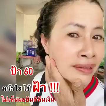 q-double-serum-เซรั่มคิว-q-serum-เซรั่มหน้าใส-คิวเซรั่ม-แท้-100