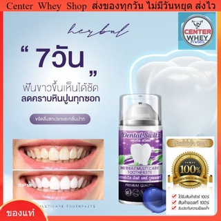1 แถม 1 จัดส่งฟรี ยาสีฟัน Dental switz