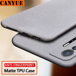 Xiaomi Mi 11T Pro 11 Lite Ultra 11tPro 11Pro 11Ultra 11Lite Matte Soft TPU Case Anti Fingerprint Back Rubber Cover