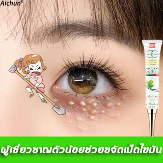 BETTER เม็ดไขมัน 30ml ลบคล้ำบวมใต้ตา กระชับรอยตีนกา ลดเม็ดไขมัน ฟื้นฟูผิวตา ครีมทารอบดวงตา เซรั่มอายครีม อายครีม