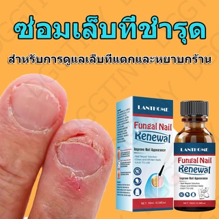 🔴 เชื้อราเล็บ 10ml ฆ่าเชื้อราที่เล็บ ยาเชื้อราเล็บ ยารักษาเชื้อราเล็บ เชื้อราที่เล็บ น้ำยารักษาเชื้อรา ซ่อมเล็บที่ชำ