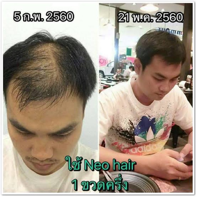 นีโอแฮร์โลชั่น-neohair-ของแท้100-ของใหม่ล่าสุด