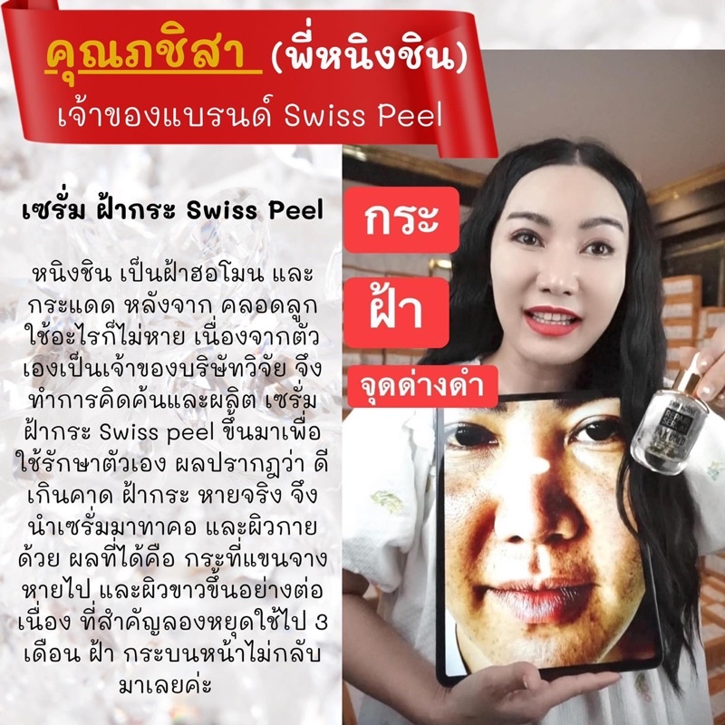 เซรั่มรักษาฝ้า-กระ-จุดด่างดำ-swiss-peel-30-ml-เซรั่มฝ้า-เซรั่มสลายฝ้า-เซรั่มหน้าใส