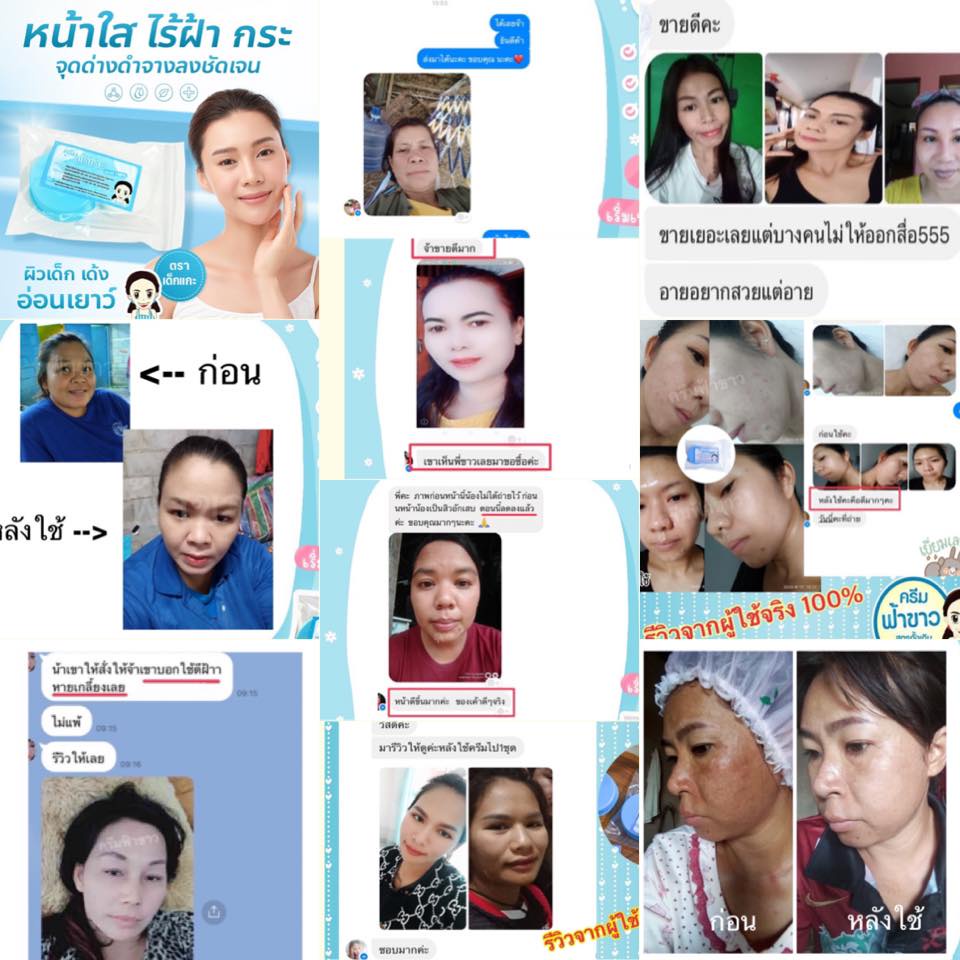 ครีมฟ้า-ขาว-เชียงรายแท้-สูตรดั่งเดิมของแท้100-พร้อมส่ง