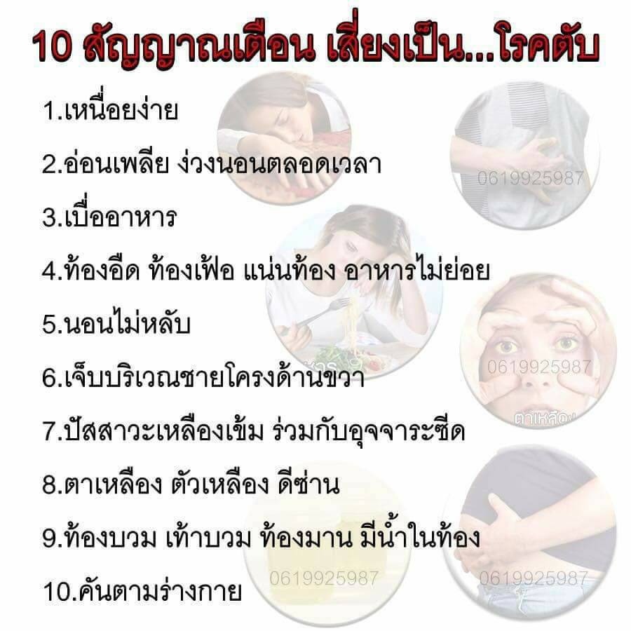 ส่งฟรี-เลซิติน-กิฟฟารีน-lecithin-ผสมแคโรทีนอยด์-และวิตามินอี-ดูแลสุขภาพตับได้-100-บำรุงตับ-ไขมันเกาะตับ