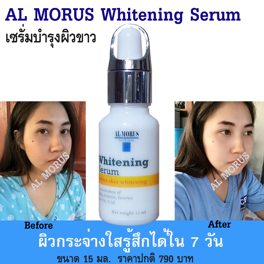 al-morus-whitening-serum-เซรั่มผิวขาว-อัลฟ่า-อาบูติน-7-สินค้าal-morus-ของแท้จากร้านal-morus-เท่านั้นได้รับของชัวร์
