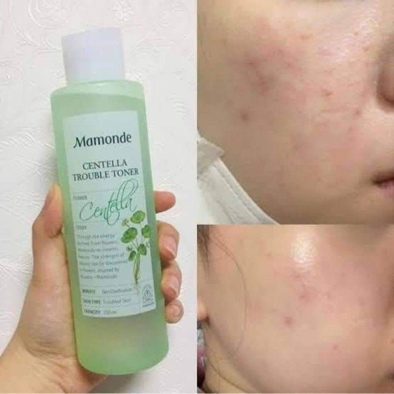 mamonde-centella-trouble-toner-250ml