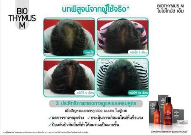 หมดอายุ03-2023-ลดผมร่วง-biothymus-ac-active-uomo-shampoo-200มล-แชมพู-สำหรับผู้ชายที่ผมบาง-ขาดร่วงง่าย