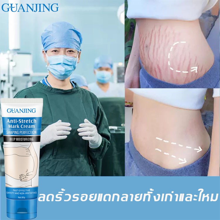 แท้ 100%Guanjingครีมทาท้องลาย ผิวแตกลาย80G🔥แก้ท้องลาย ลดรอยแตกลาย ขาแตกลาย  สะโพกลาย ผิวลาย รอยแตกลาย ครีมลดรอยแตกลาย ครี | Shopee Thailand