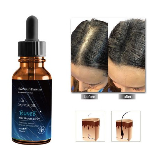 bunee-hair-growth-serum-เซรั่มบำรุงหนังศรีษะปลูกเส้นผมใหม่