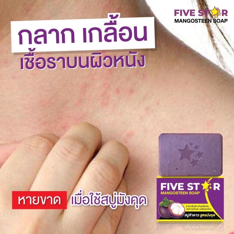 five-star-สบู่มังคุด