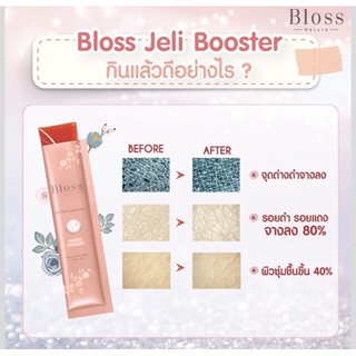 ภาพขนาดย่อของภาพหน้าปกสินค้าBloss Jeli Aura Booster/ Bloss Jeli Clear Booster (กล่องใหญ่ 14ซอง/กล่องเล็ก 5ซอง) พร้อมส่งค่ะ จากร้าน blossombaby บน Shopee ภาพที่ 4