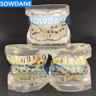 Transparent Dental Orthodontic Mallocclusion Model with Brackets Archwire buccal tube Tooth Extraction for Patient Commu