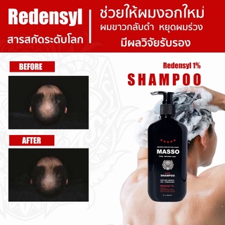 Masso Hair Shampoo มัสโซ่ แฮร์ แชมพู ผลิตภัณฑ์ ปลูกผม ด้วยสารสกัด Redensyl ช่วยผมงอกใหม่ ลดการขาดหลุดร่วง