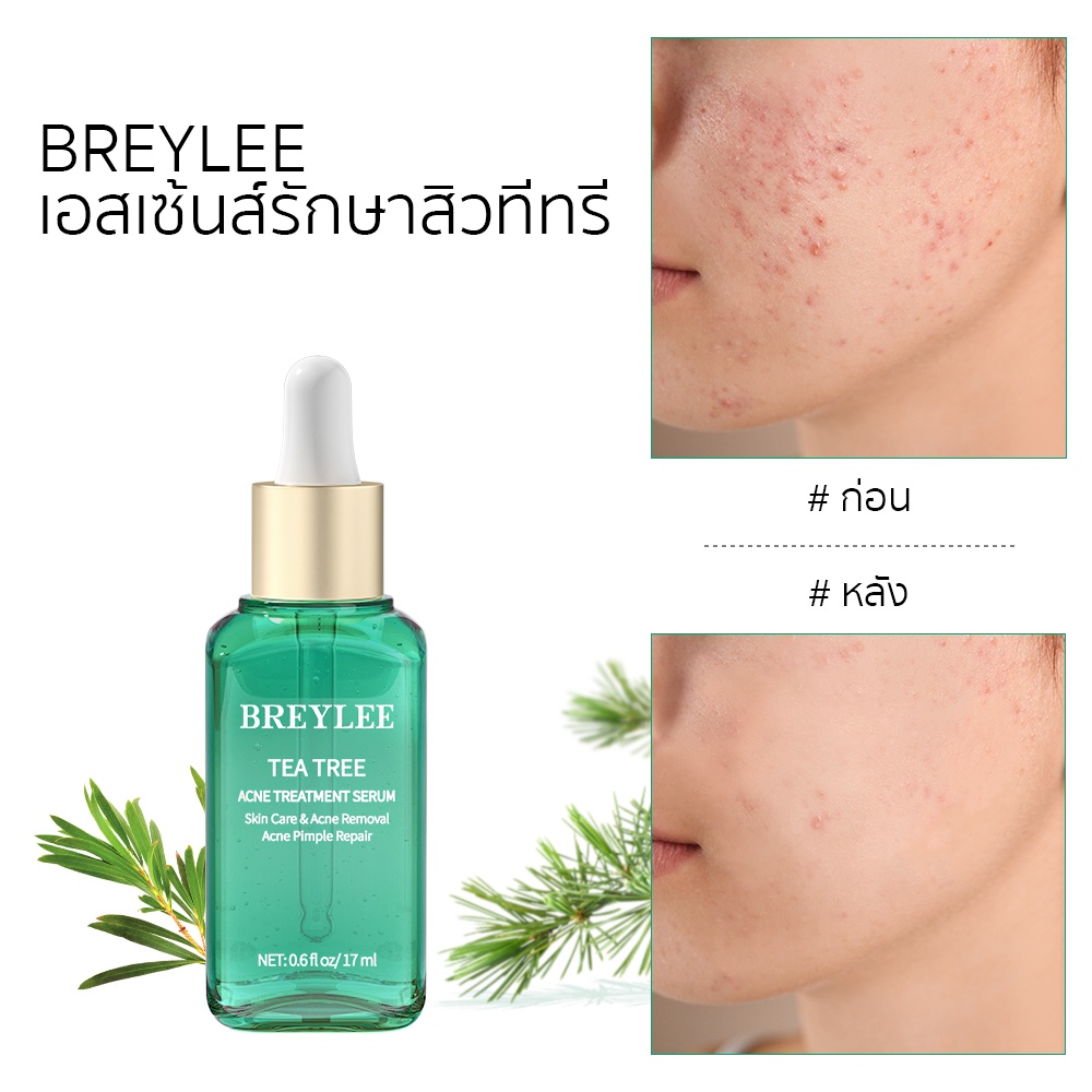 breylee-เซรั่มลดสิว-เซรั่มรักษาสิว-เซรั่มบำรุงผิวหน้า-ป้องกันสิว-สูตรช่วยลดสิวและควบคุมความมัน