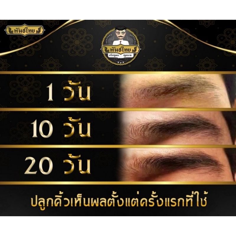 เซรั่มปลูกผมพันธ์ไทย-ปลูกคิ้ว-ปลูกหนวด-ปลูกผม-เห็นผลจริง