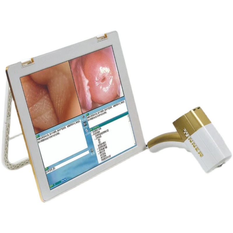 portable-colposcope-cervical-detection-instrument-female-private-inspection-mirror-hd-gynecological-endoscope-speculum-y