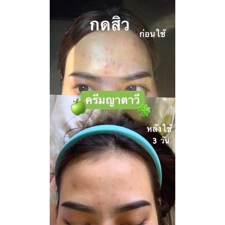 ครีมญาตาวี-แอปเปิ้ลเขียว-ครีมลดสิว-หน้าใส-แบรนด์ซ้อจอย