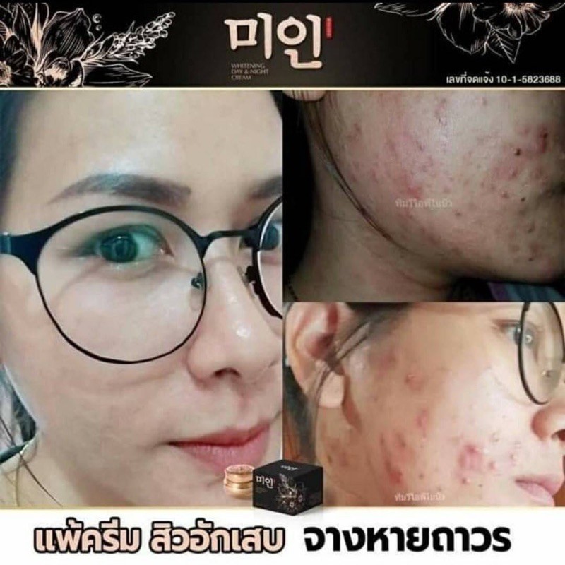 ครีมไข่มุกเกาหลีของแท้1000000-ครีมคุณกวาง