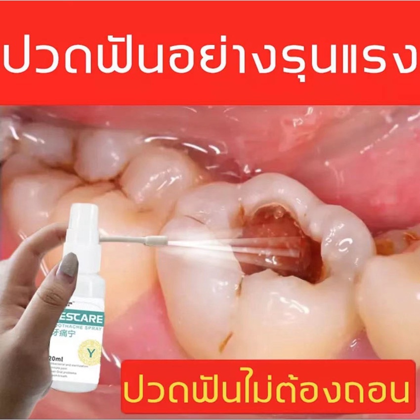 สั่งซื้อ ยาสีฟัน แก้ปวดฟัน ในราคาสุดคุ้ม | Shopee Thailand