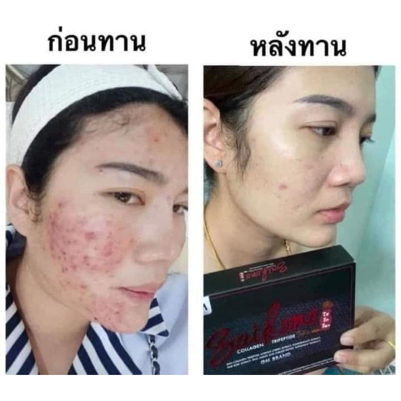 แท้100-สูตรใหม่-คอลลาเจนไซโกโน๊ะ-saikono-collagen-คอลลาเจนผิวขาว