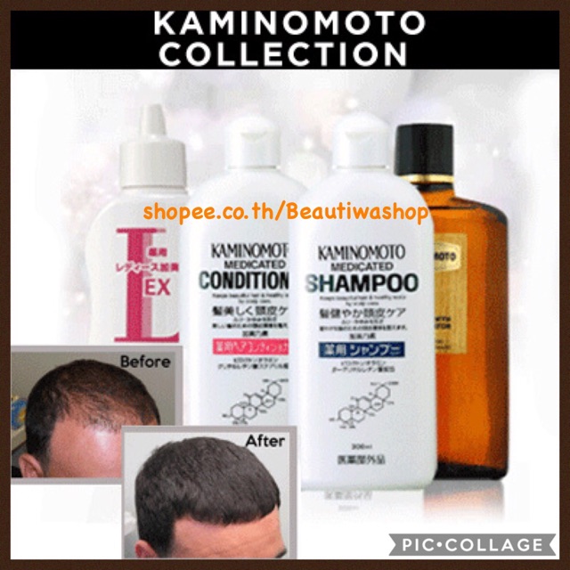 kaminomoto-แชมพูทำความสะอาดเส้นผมและหนังศีรษะ-แก้รังแค-หยุดผมร่วงเห็นผล-medicated-shampoo-b-amp-p-300ml-คามิโนโมโต-เมดิเคท