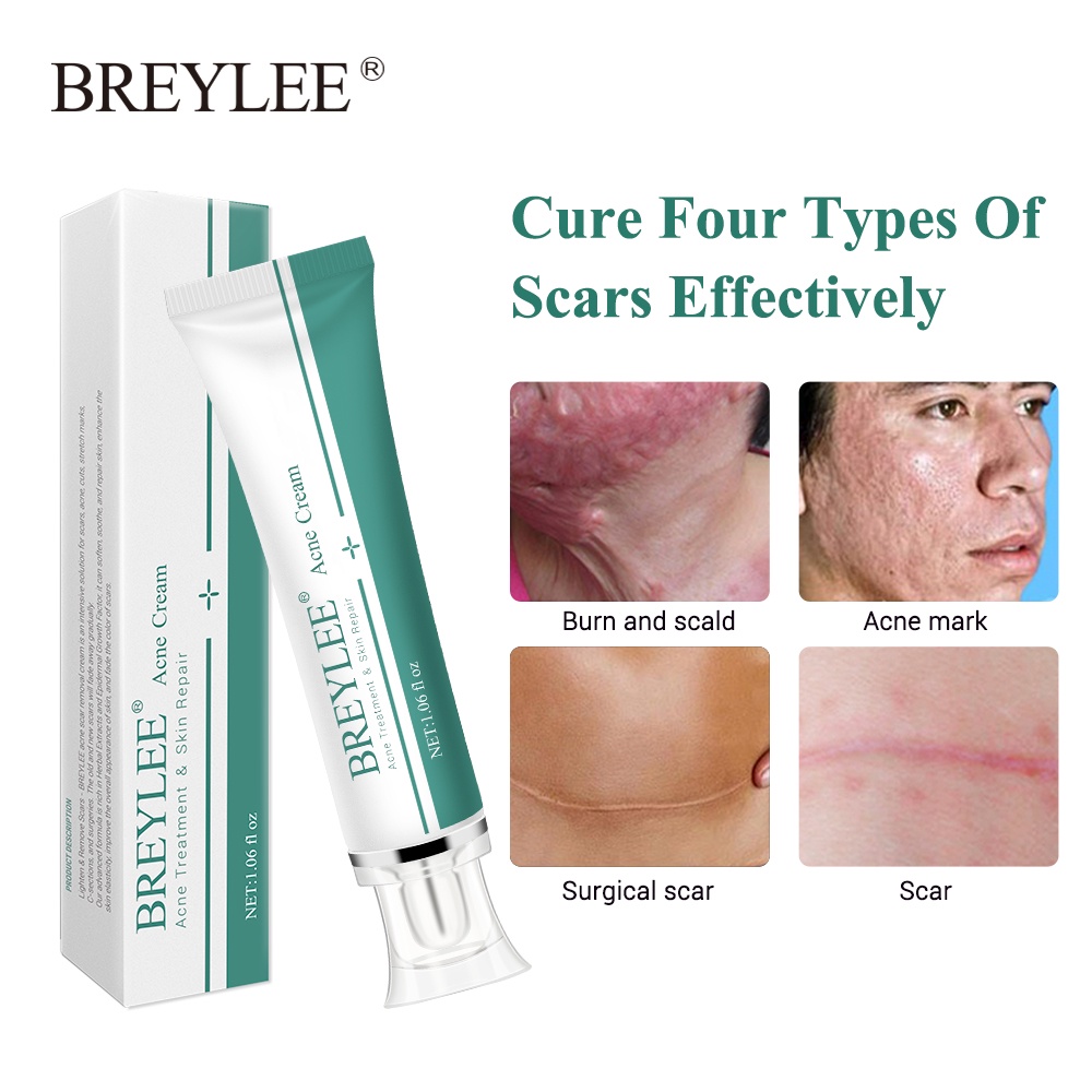 breylee-scar-removal-gel-30g-ครีมลดรอยแผลเป็น-ลดผิวแตกลาย-ลบรอยแผลเป็น-ลดเลือนป้องกันรอยแผลเป็น